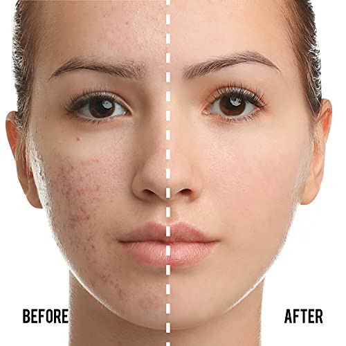 Catkin Phoenix Cushion Foundation Buildable Coverage AntiAging Serum Makeup Sheer Satin Finish Refill Included Light Bei