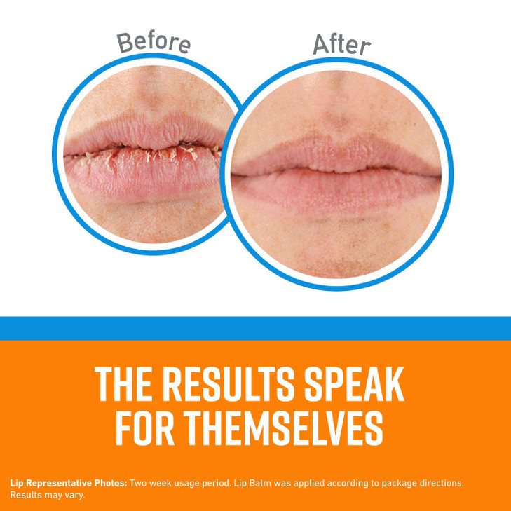 OKeeffes Cooling Relief Lip Repair Lip Balm for Dry Cracked Lips Stick Pack of 3