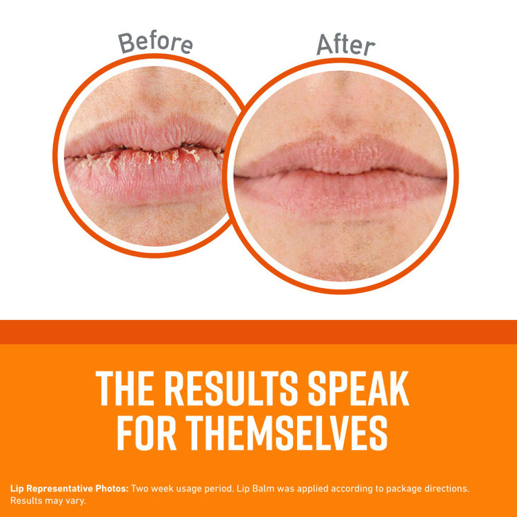 OKeeffes Unscented Lip Repair Lip Balm for Dry Cracked Lips Stick Pack of 12