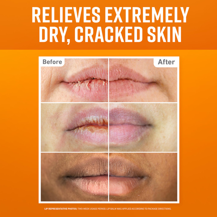 OKeeffes Lip Repair Lip Balm Set for Dry Cracked Lips Stick Pack of 3 1 Cooling 1 Unscented 1 SPF Moisturizer for for Ex