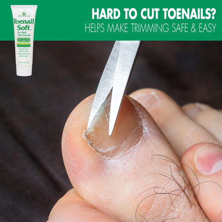 Toenail Softener for Thick Hard Toenails Safe for Seniors All Ages FastActing Toenail Softening Cream Non Greasy Nail Cr