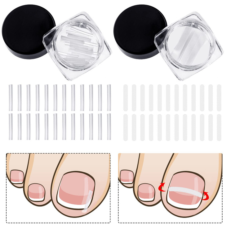 60 Pieces Ingrown Toenail Corrector Strips Ingrown Toe Nail Correction Brace Correction Clip Toe Nail Straightening Reco