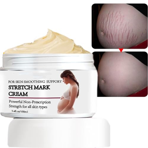 Rosarden Stretch Mark Prevention Cream for Pregnancy, Stretch Mark Cream Remover, Stretch Mark Lotion for Pregnancy, Tummy Butter for Stretch Marks P