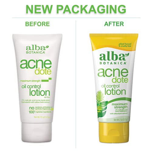 Alba Botanica Acnedote Maximum Strength Oil Control Lotion 2 Oz