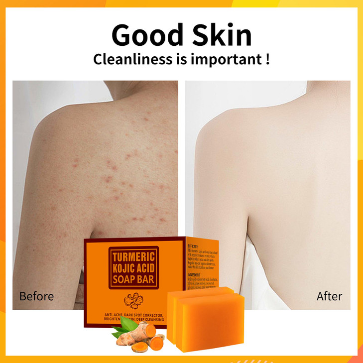 Koji Acid Soap for Dark Spots Turmeric Soap for Face and Body Kojic Acid Soap Skin Brightening Tumeric Soap for Acne Dar