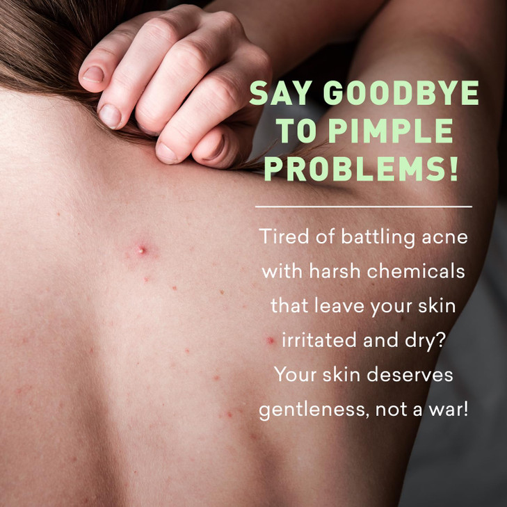 Just Nutritive Acne Clear Face and Body Wash Adult Acne Treatment Acne Face Wash Face Skin Care Back Acne Treatment Acne