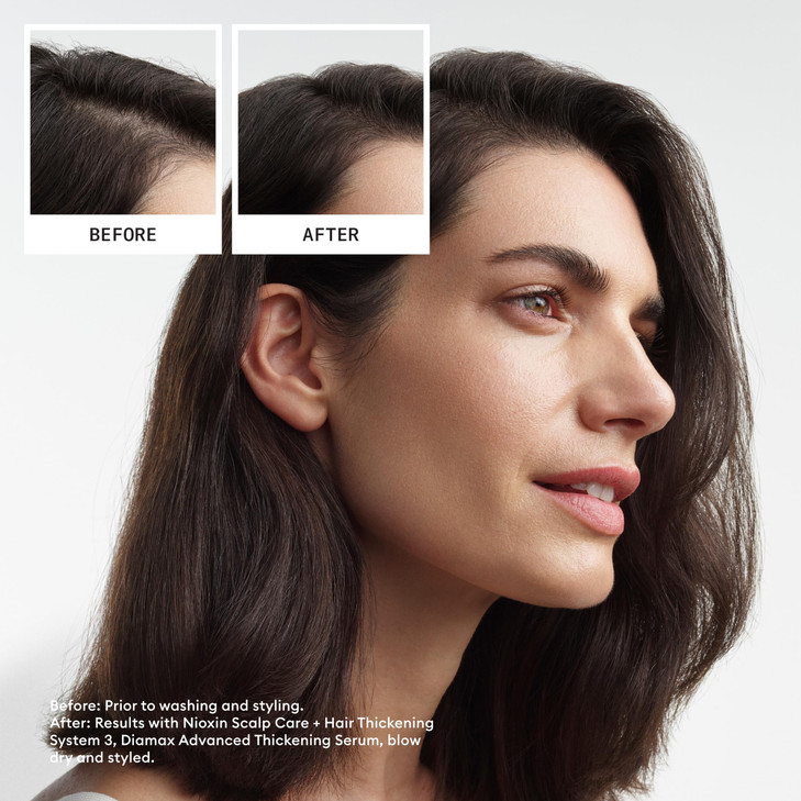 Nioxin System 3 Scalp Hair Shampoo For Colored or Damaged Hair with Light Thinning With Niacinamide and Biotin 101 Fl oz