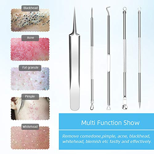 Best Blackhead Remover Blackheads Blemish Removing Acne Whitehead Removal Kit Pimple Comedone Extractor Tool Popper Pimp