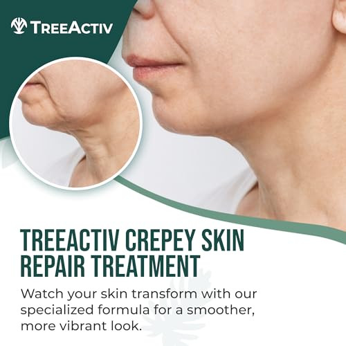 TreeActiv Crepey Skin Repair Cream 8 oz Firming Body Neck Cream with Hyaluronic Acid Glycolic Acid Shea Butter Helps Cre