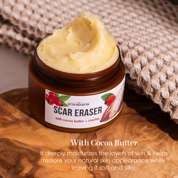 Better Shea Butter Scar Eraser Balm Cocoa Butter Cream for Stretch Marks and Dark Spots Burns Old Scars Acne Scars Desig