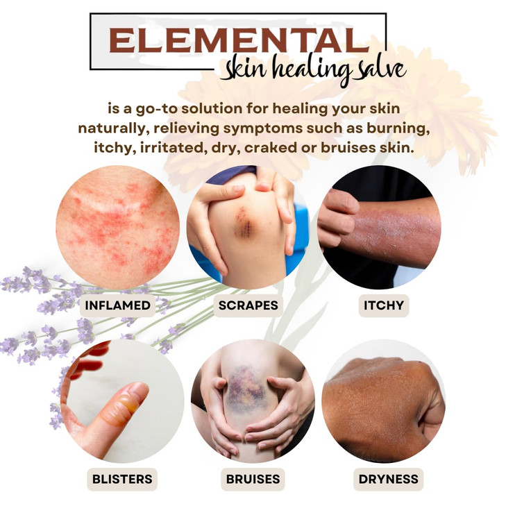 Elemental Wellness Shop Skin Healing Salve Repair Dry Cracked Skin All Natural Organic Vegan Ointment to Nourish Support