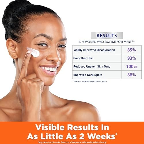 Palmers Skin Success AntiDark Spot Nighttime Fade Cream with Retinol Niacinamide Dark Spot Corrector for Face Night Mois