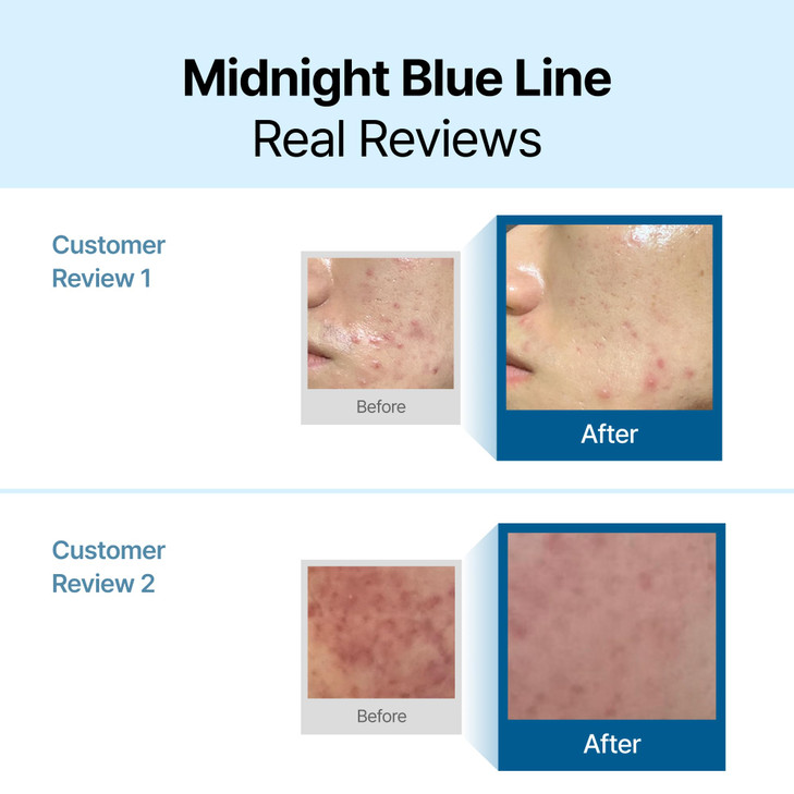 DearKlairs Midnight Blue Calming Cream Soothing Face Moisturizer for Oily Sensitive Skin Redness Relief Hydrating Lightw