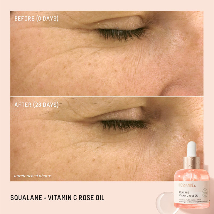 BIOSSANCE Squalane Vitamin C Rose Advanced Facial Oil Brightening Firming and Hydrating Serum for All Skin Types Chios C