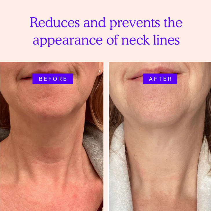 BLUMBODY Neck Wrinkle Patches AntiWrinkle Silicone Patches for Skin Firming Tightening Reusable Overnight Pads AntiAging