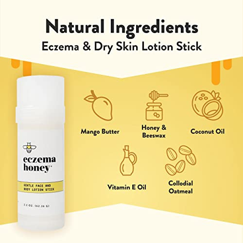 ECZEMA HONEY Gentle Face Body Lotion Stick Moisturizing Colloidal Oatmeal Hand Cream for Extremely Dry Skin Eczema Lotio