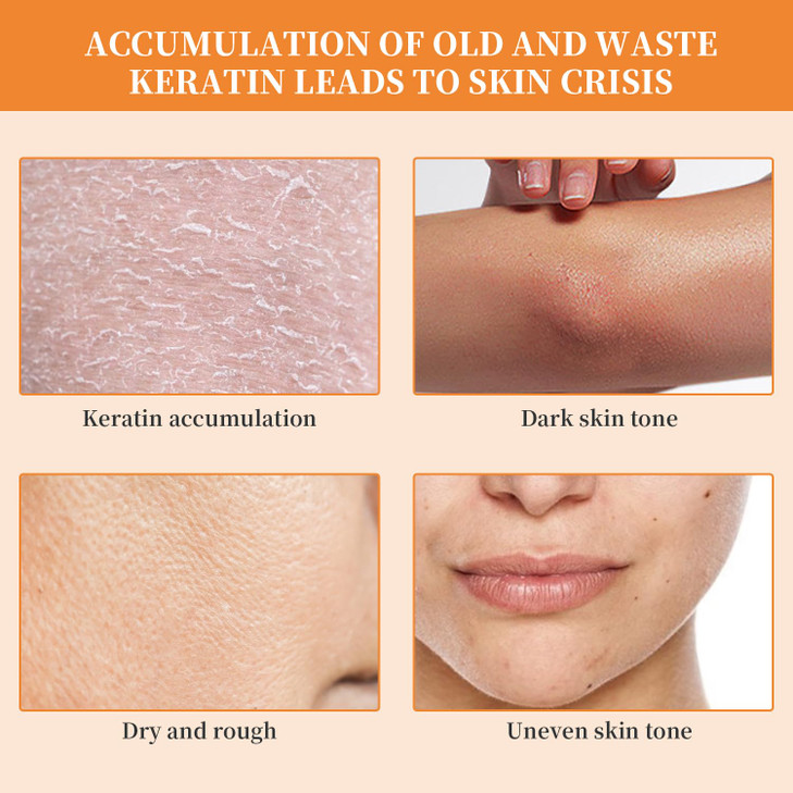 Orange Exfoliating Gel Scrub Face Body SkinNatural Orange Peeling Gel Face ScrubDeep Cleansing Moisturizing Facial Exfol