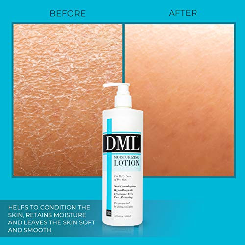 DML Moisturizing Lotion 16 Fl Oz