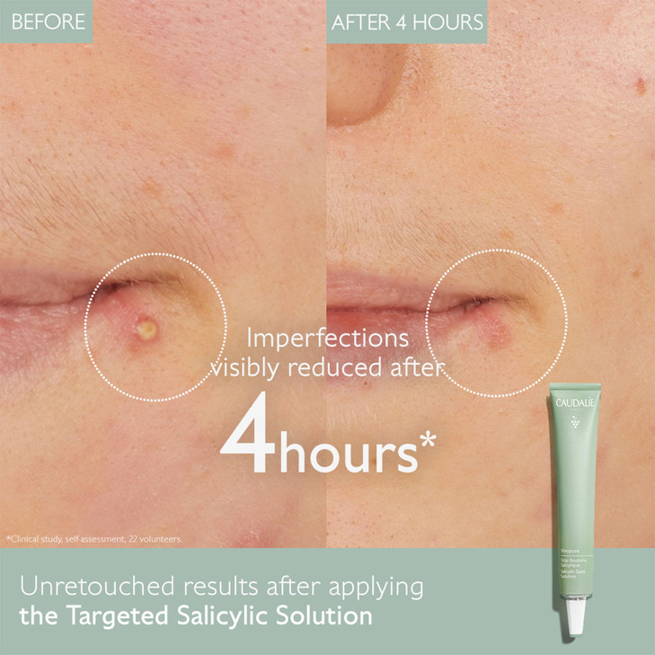 Caudalie Vinopure Color Correcting Spot Solution with Salicylic Acid 15 mL