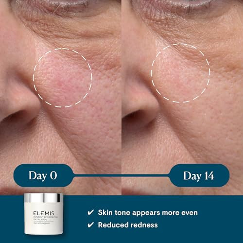 ELEMIS Dynamic Resurfacing Facial Pads Blackhead Refining Treatment Gentle Daily Skin Resurfacer Lactic Acid TriEnzyme 6