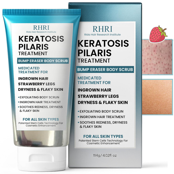 KP Bump Eraser Body Scrub with 10 AHA Keratosis Pilaris Treatment Bump Eraser Body Scrub Ingrown Hair Treatment Clears S