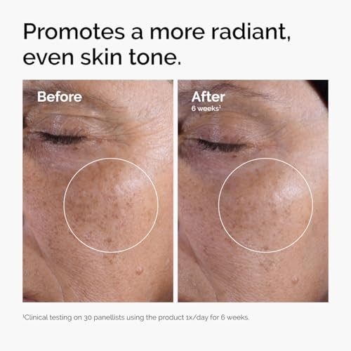 The Ordinary Glycolic Acid 7 Exfoliating Toner Brightening and Smoothing Daily Toner for More EvenLooking Skin Tone 81 F