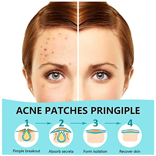 PICcircuit 180 Counts Pimple Patches for Face Hydrocolloid Acne Patches for face Invisible Zit Patches for Face Pimple P