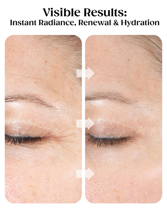 KAPLAN MD Diamond Contour Supercharged 1 Minute Daily Facial AntiAging Serum for Face with Exfoliating Crushed Diamonds