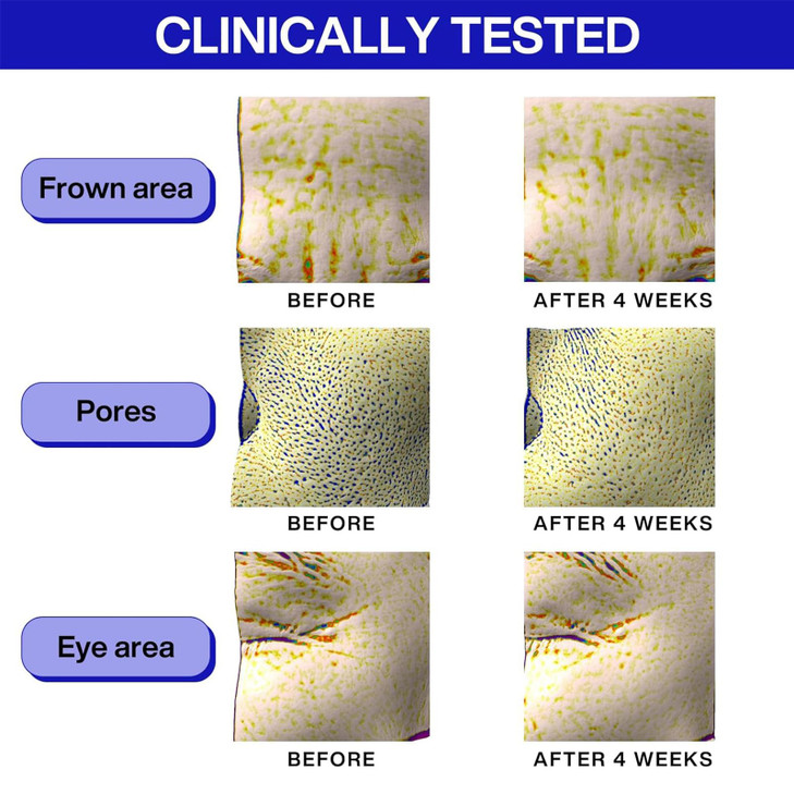 IOPE Retinol Super Bounce Serum Korean Retinoid Eye Treatment for AntiAging Beginner Friendly Reduction in Fine Lines Wr