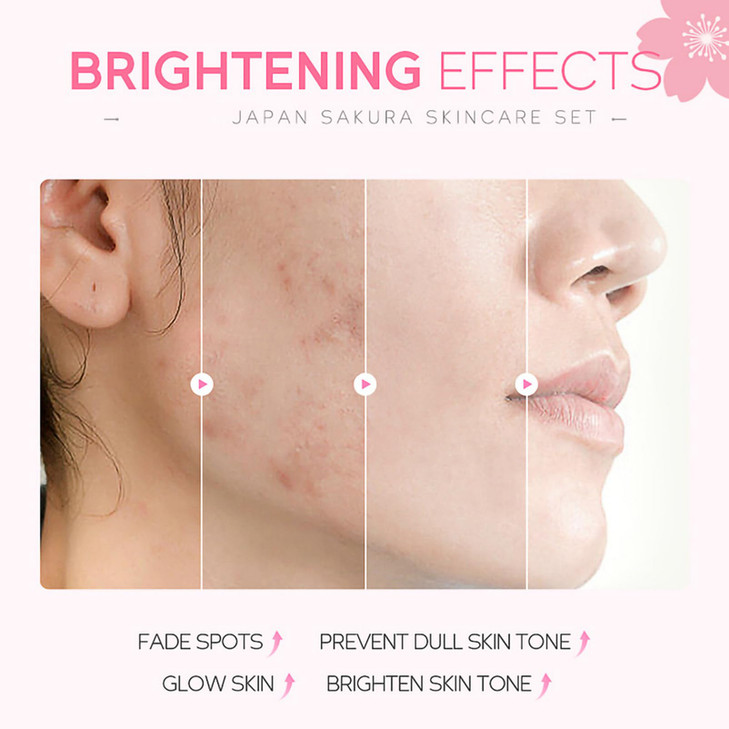 Skincare Gifts For Teenage GirlsCherry Blossom Skincare SetsFacial kitPamper Sets For Women GiftsSkin Care Sets Kits One