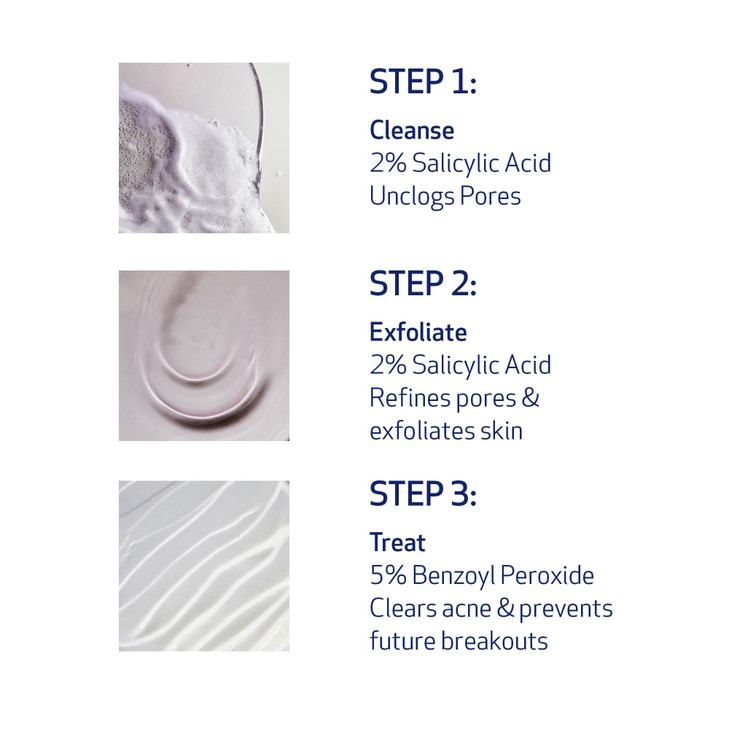 Obagi CLENZIderm MD Therapeutic System 3 Step Acne Treatment System Includes 2 Salicylic Acid BHA Cleanser 2 Salicylic A