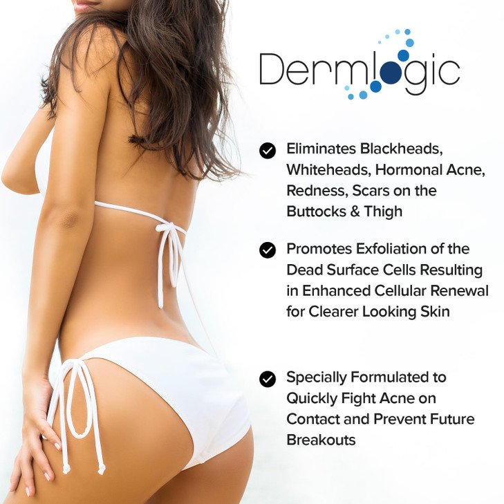 Butt Thigh Acne Treatment Clears Away Acne Pimples and Ingrown Hairs for the Buttocks and Thigh Area Prevents Future Bre