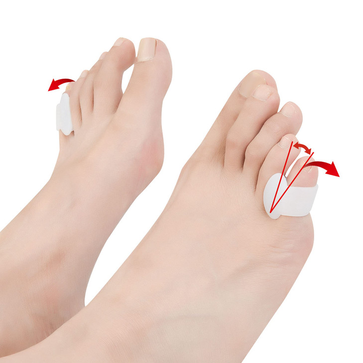 Hoogoo Toe Spacers for Feet Women Man Bunion Corrector Pinky Toe Separators Silicone Small Toe Protector Spreader Toe Co