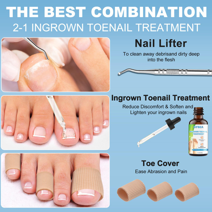 Ingrown Toenail Treatment wIngrown Toenail Drops Reliever SoftenerDouble Sided Pedicure Nail Lifter Tool for Easy Trimmi