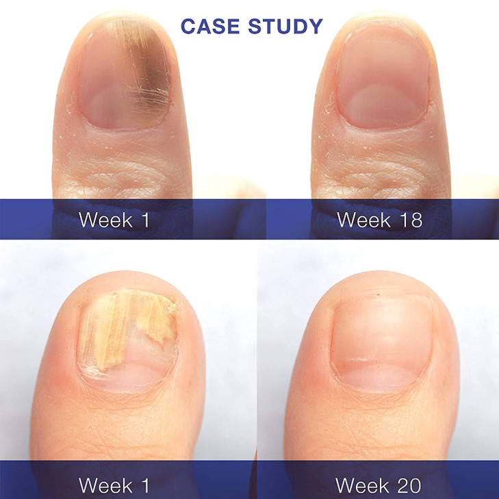 Dr Luke Nail Repair Liquid Restorative Nail Repair for Damaged Nails Nail Cuticle Care for HealthyLooking Nails 1 oz Pac