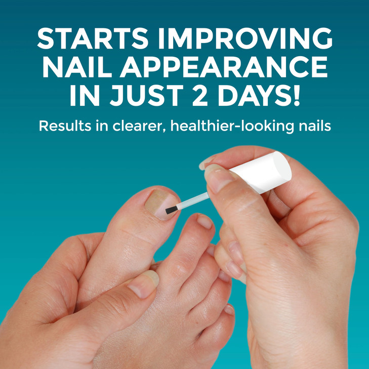 OptiNail Fungal Nail Repair with Brush Applicator Restores the Healthy Appearance of Nails Discolored or Damaged by Nail