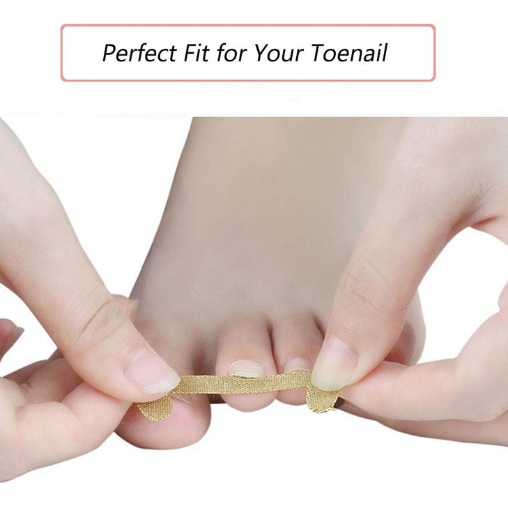 EBANKU Ingrown Toenail Treatment Strips 20 Pcs Toe Nail Correction Patch Elastic Patch Sticker Corrector Pedicure Tools
