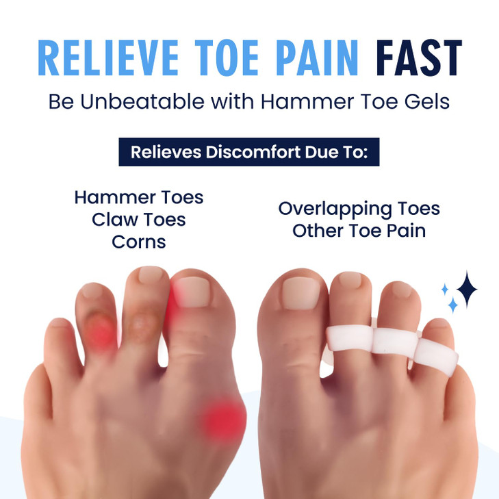 Dr Fredericks Original Hammer Toe Corrector Gels 2 Pairs AllDay Relief for Crooked Overlapping Toes Soft Cushioning Symp
