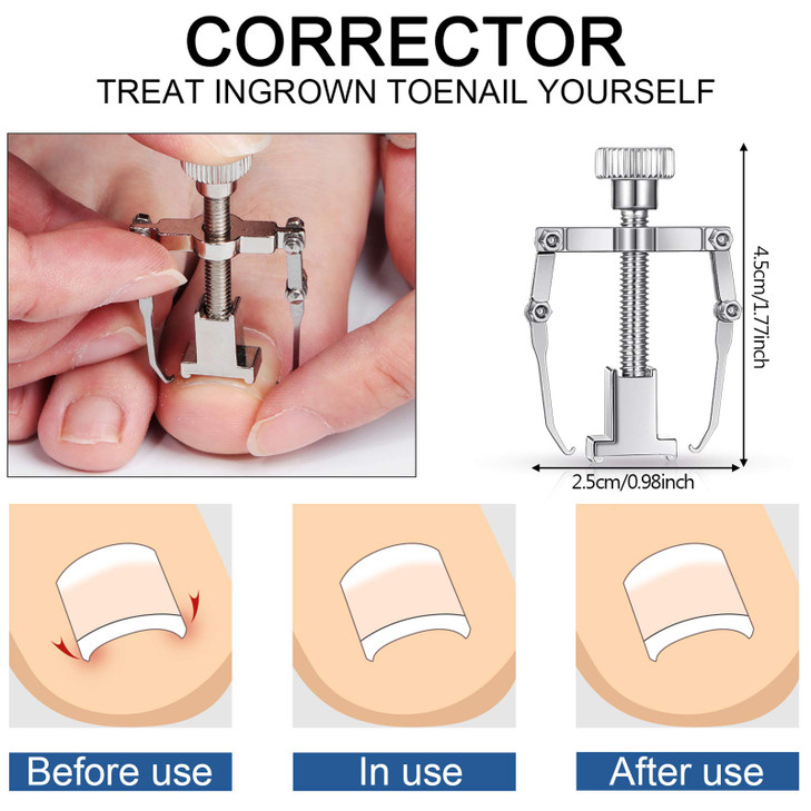 15 Pieces Ingrown Toenail Tools Stainless Steel Foot Nail Tools Toenail File and Lifter Nail Clipper Cuticle Cutters Cut