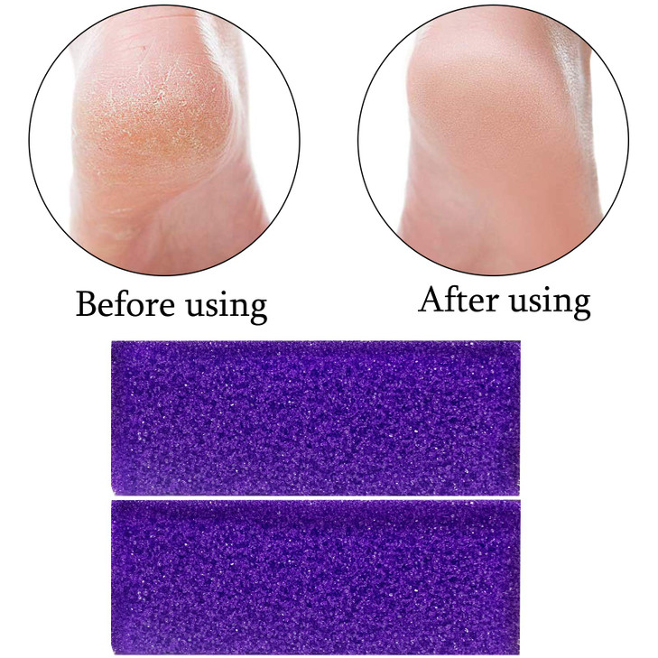 40 Pcs Pumice Stone for Feet Foot Scrubber Sponge for Feet Care and Callus Remover Mini Disposable Pumice Pads for Dead