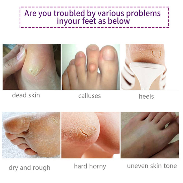 Foot Peel Mask 5 PackLavender Exfoliating Foot Masks Soft Smooth Touch Natural Exfoliator for Dry Dead Skin Callus Repai