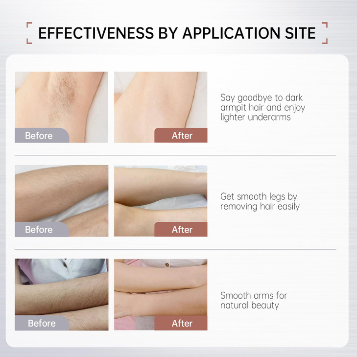 VGO Painless Bikini Gel for Women Men Unwanted Hair Removal for All Skin Types 120ml 406oz