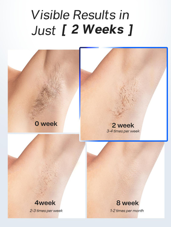 Blex Laser Hair Removal for Women and Men IPL Laser Hair Removal Device with Permanent Results Effective in 2 Weeks Ultr