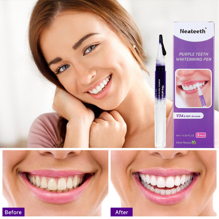 Teeth Whitening Gels Pen Purple Teeth Whitening Pens Instant Teeth Whitening Paint Pens Color Correcting for Tooth Stain
