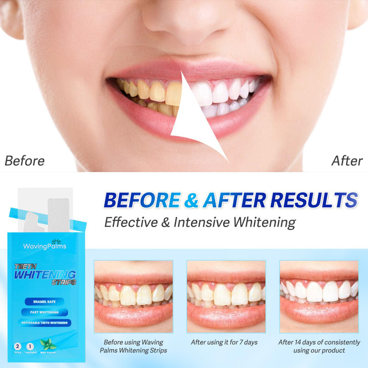 Waving Palms Teeth whitening Strips for Tooth White Professional Dental Teeth whitening Strips 28 whitening Strips White