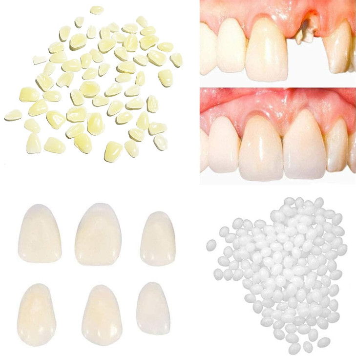 Tooth Repair KitThermal Fitting Beads Granules and Fake Teeth for Temporary Fixing Missing and Broken ToothReplace a Mis