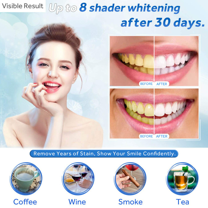 EZGO 10 Pack Teeth Whitening Gel Refills 22 Bleaching Gel No Sensitive Teeth Whitener Great for Sensitive Tooth Whitenin