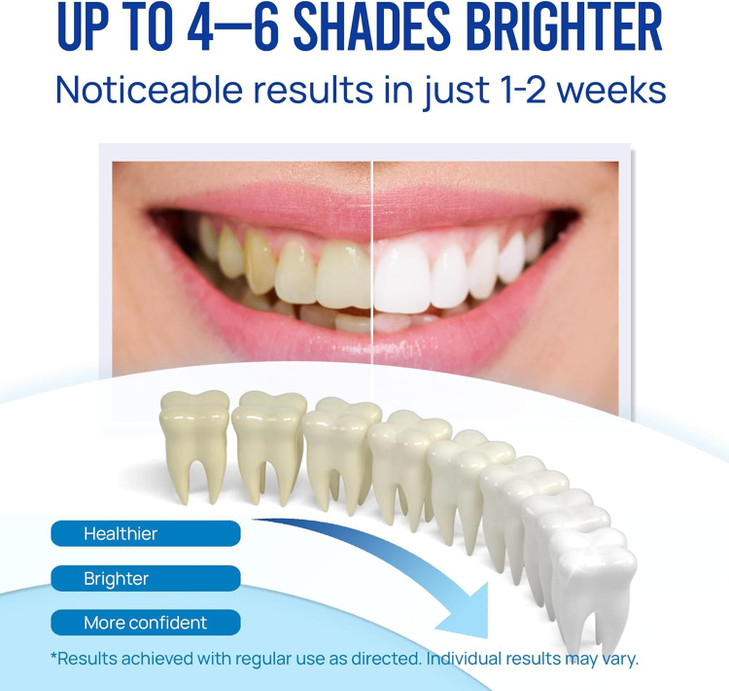 VieBeauti Teeth Whitening Pen 3 Pcs 30 Uses Effective Painless No Sensitivity TravelFriendly Easy to Use Beautiful White