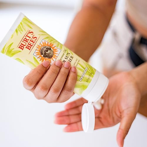 Burts Bees After Sun Lotion with Hydrating Aloe Vera Coconut Oil Summer Essentials Sunburn Relief Natural After Sun Soot