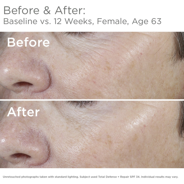 SkinMedica Total Defense Repair SPF 34 Sunscreen for Face This Lightweight Facial Sunscreen is Ideal for Oily andor Comb